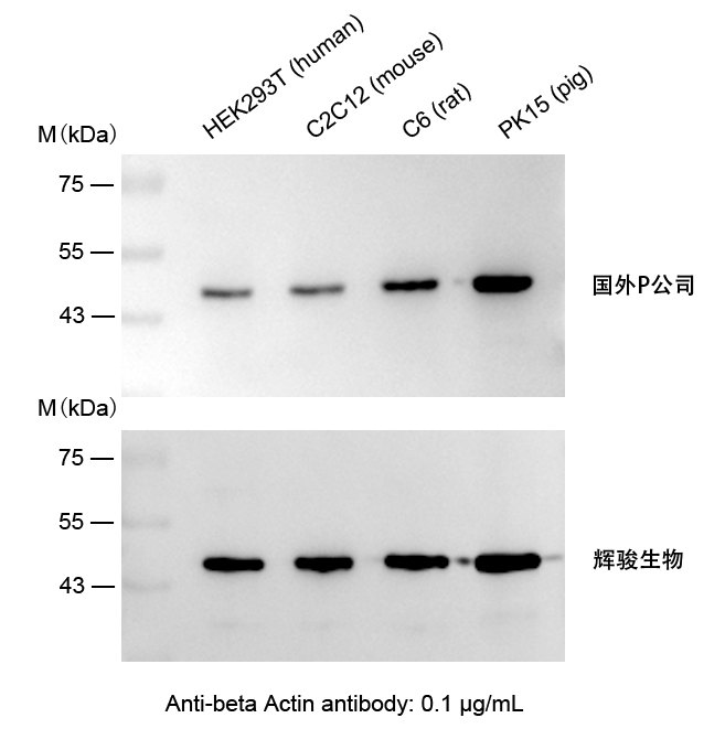 β-Actin小鼠單克隆抗體使用案例-抗體操作簡(jiǎn)單,快速制備Actin抗體-輝駿生物